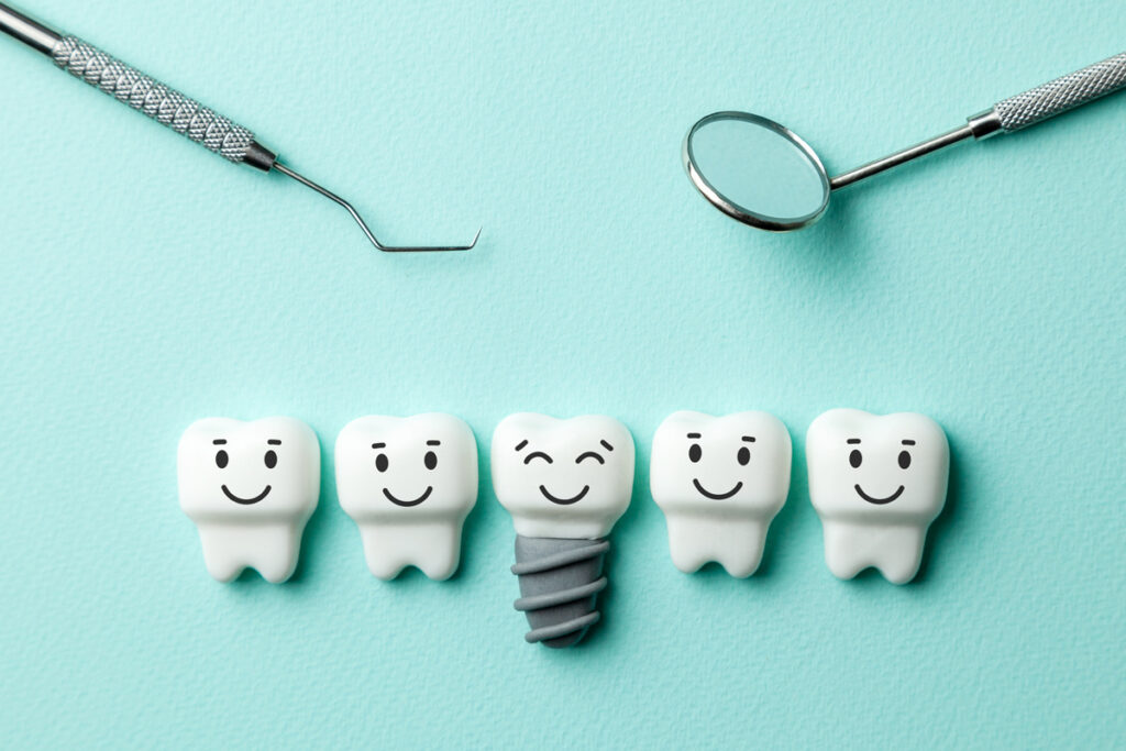 Modern Tooth Restoration Options