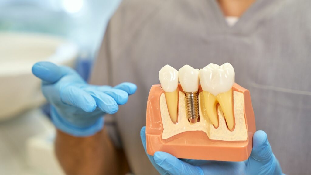 Don't Let Anxiety Keep You From Getting Dental Implants: Here's What to Expect