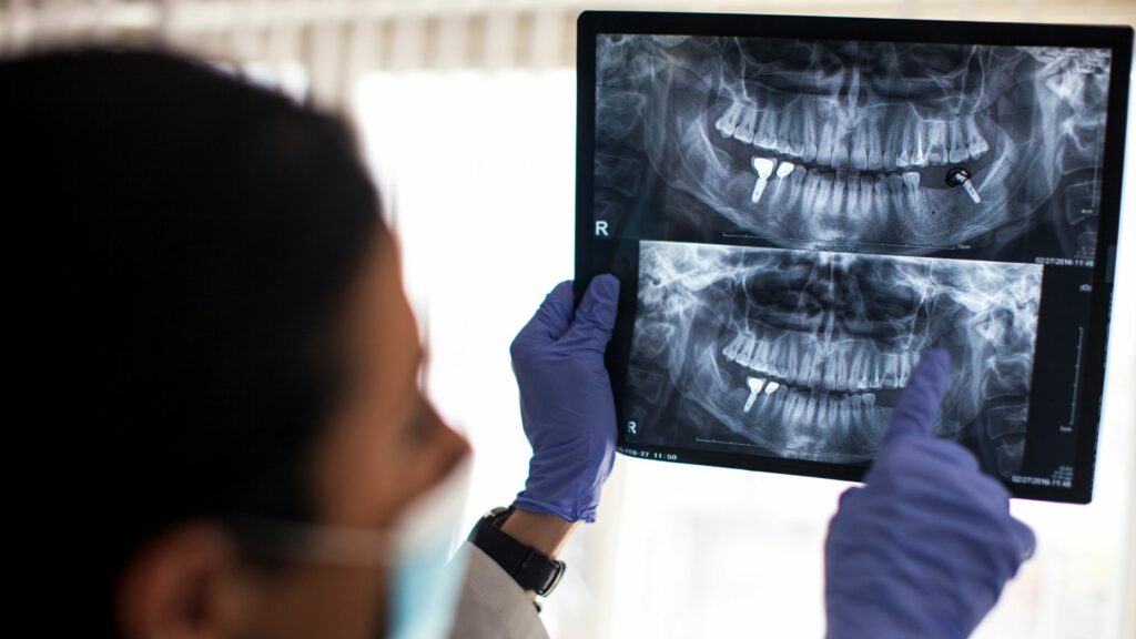 When Dental Implants Are Likely Your Best Option: Top 3 Scenarios